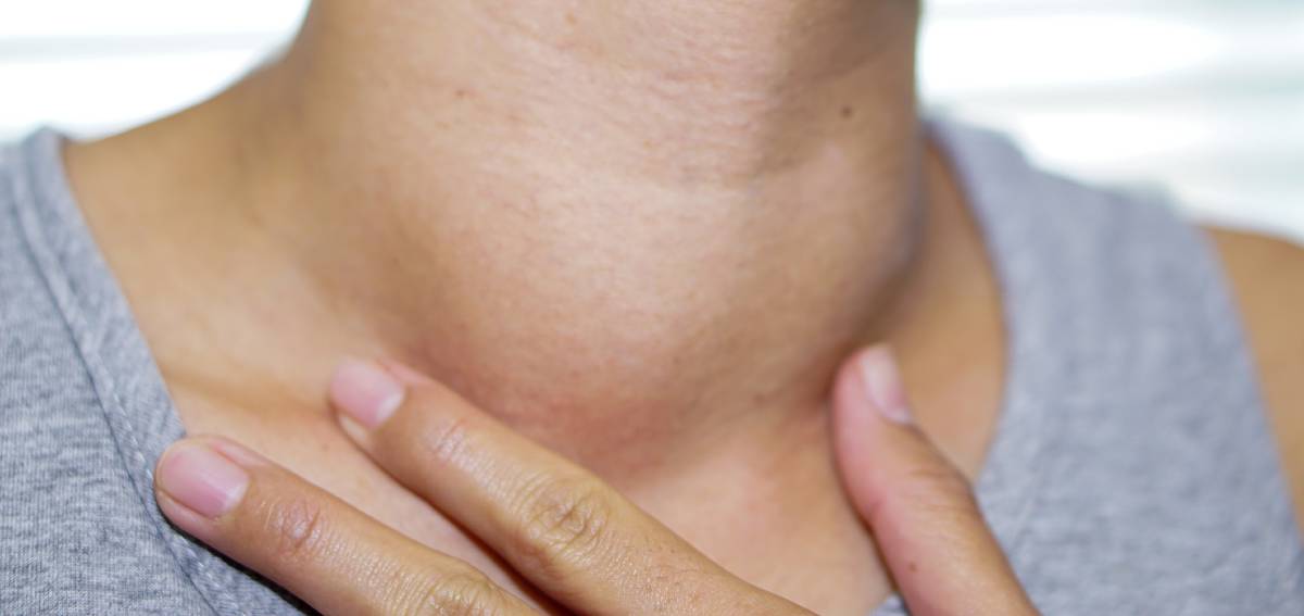 head and neck cancer symptoms