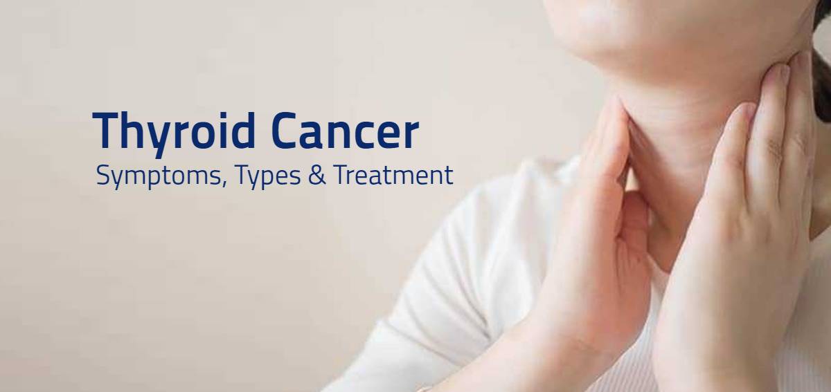 Thyroid Cancer
