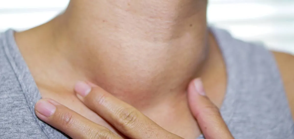 head and neck cancer symptoms