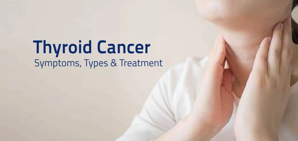 Thyroid Cancer